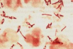 世界毒性強的十大毒藥：炭疽第三，肉毒桿菌問鼎冠軍